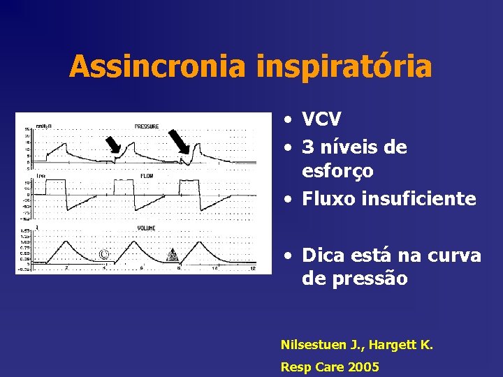 Assincronia inspiratória • VCV • 3 níveis de esforço • Fluxo insuficiente • Dica