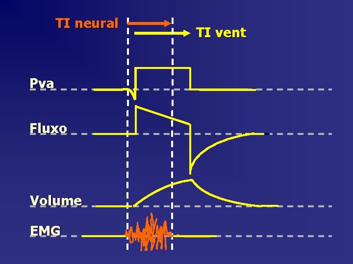 TI neural Pva Fluxo Volume EMG TI vent 