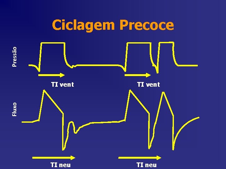 Pressão Ciclagem Precoce TI vent TI neu Fluxo TI vent Pressão Ciclagem Precoce TI vent TI neu Fluxo TI vent