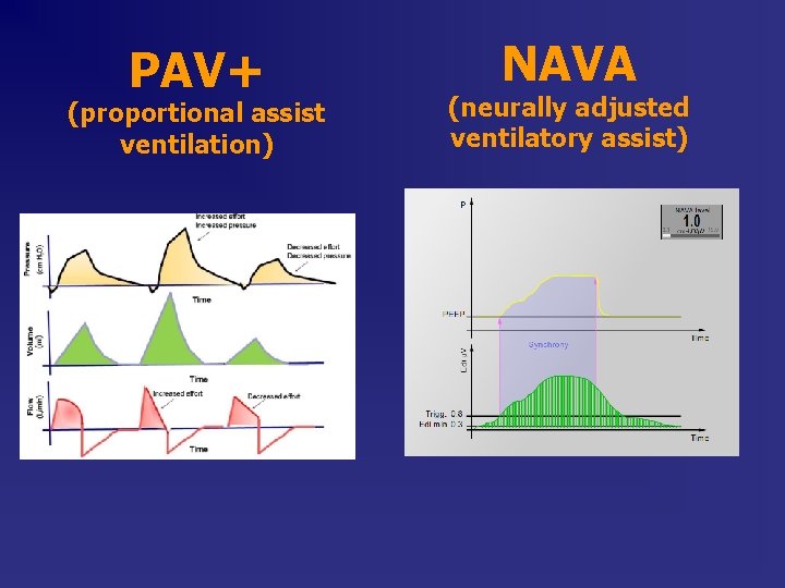 PAV+ (proportional assist ventilation) NAVA (neurally adjusted ventilatory assist) 
