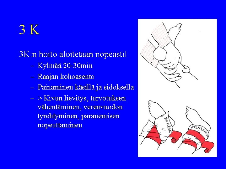 3 K 3 K: n hoito aloitetaan nopeasti! – – Kylmää 20 -30 min