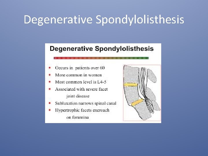 Degenerative Spondylolisthesis 