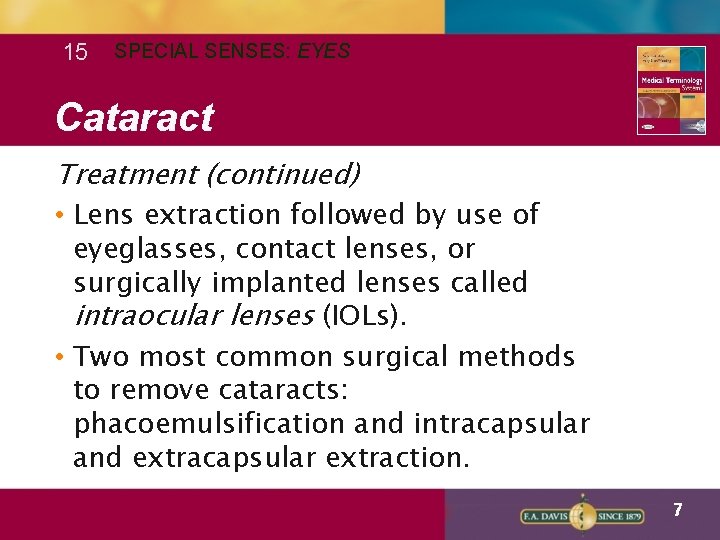 15 SPECIAL SENSES: EYES Cataract Treatment (continued) • Lens extraction followed by use of