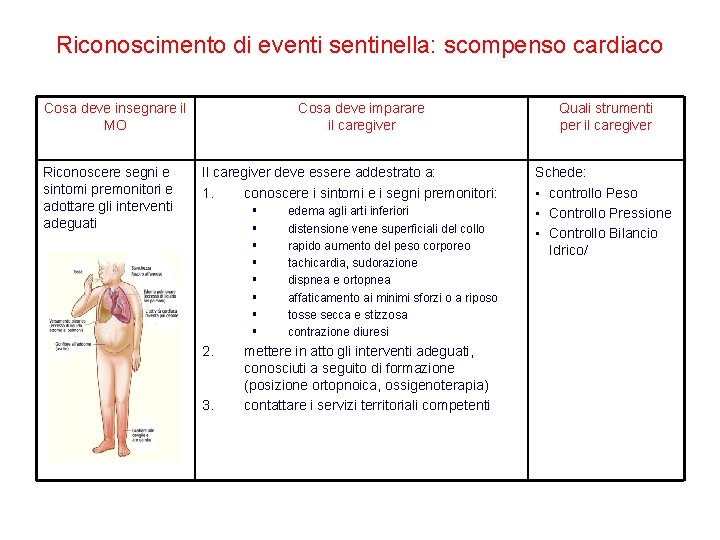 Riconoscimento di eventi sentinella: scompenso cardiaco Cosa deve insegnare il MO Riconoscere segni e Riconoscimento di eventi sentinella: scompenso cardiaco Cosa deve insegnare il MO Riconoscere segni e