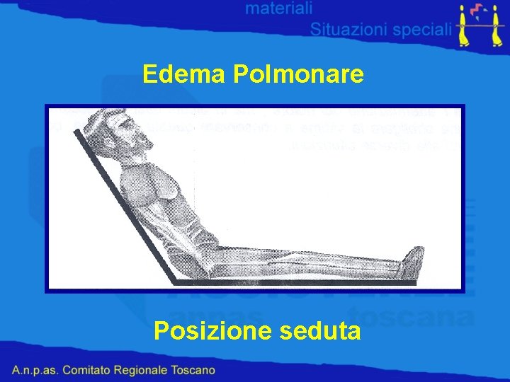 Edema Polmonare Posizione seduta 