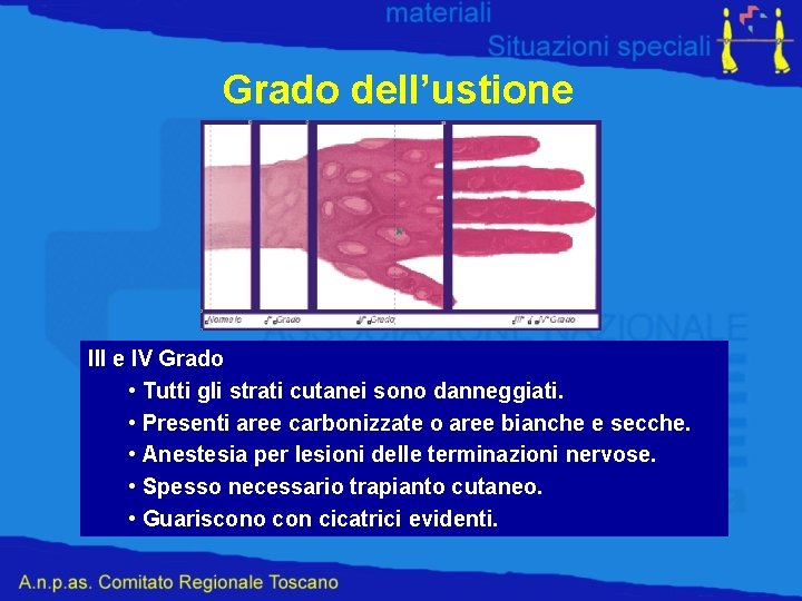 Grado dell’ustione III Grado III e IV Grado • Tutti Ustione L’ustione gli strati