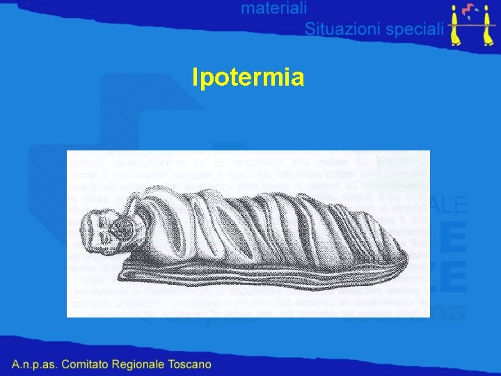 Ipotermia 