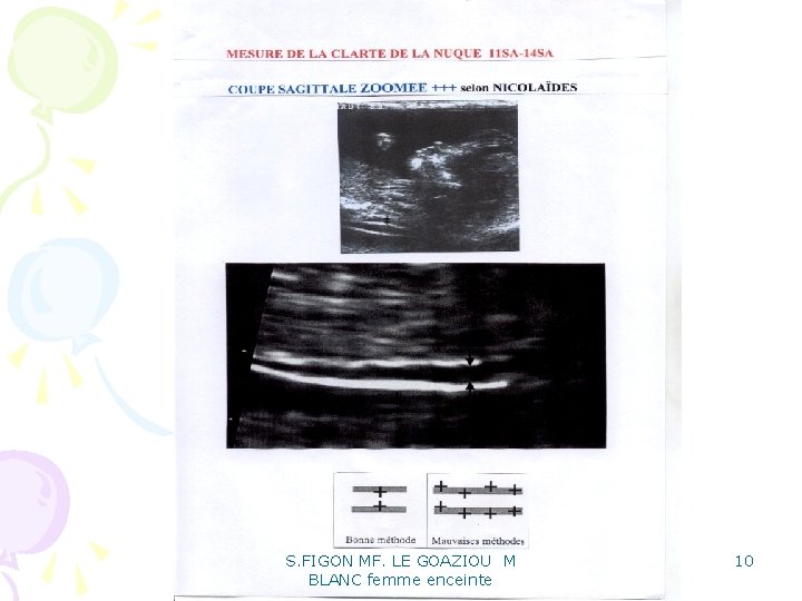 S. FIGON MF. LE GOAZIOU M BLANC femme enceinte 10 S. FIGON MF. LE GOAZIOU M BLANC femme enceinte 10