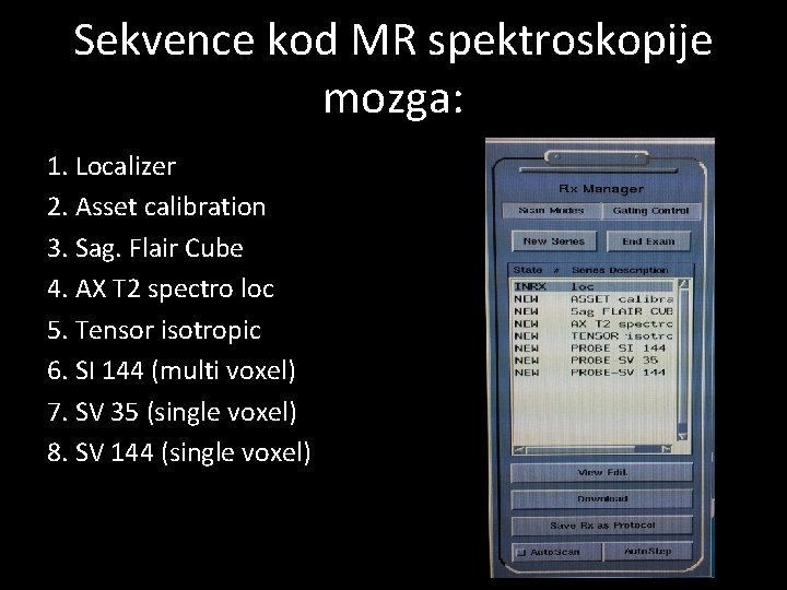 Sekvence kod MR spektroskopije mozga: 1. Localizer 2. Asset calibration 3. Sag. Flair Cube