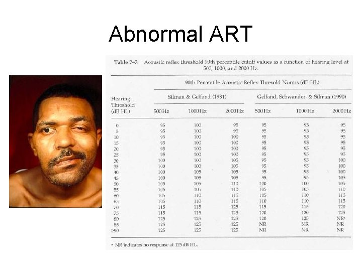 Abnormal ART 