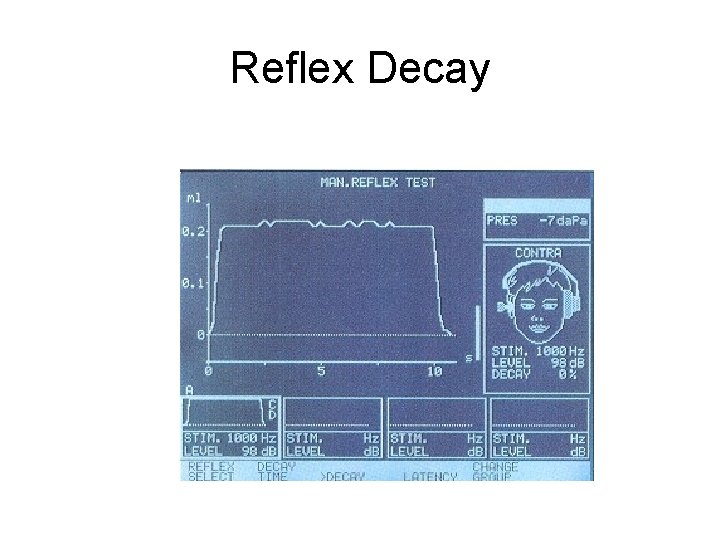 Reflex Decay 