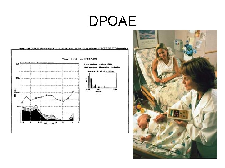 DPOAE 