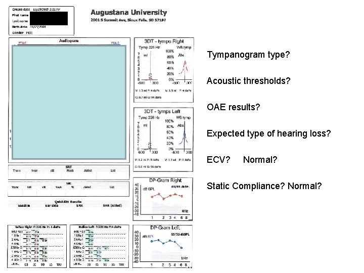 Tympanogram type? Acoustic thresholds? OAE results? Expected type of hearing loss? ECV? Normal? Static