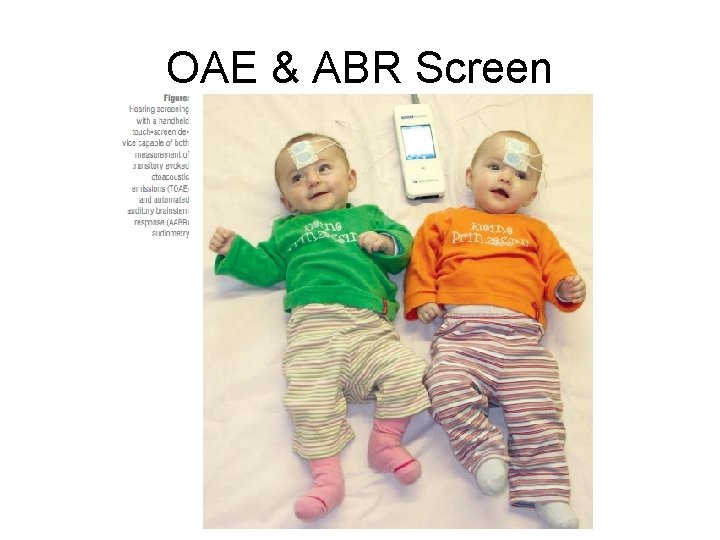 OAE & ABR Screen 