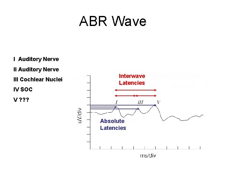 ABR Wave I Auditory Nerve III Cochlear Nuclei Interwave Latencies IV SOC V ?