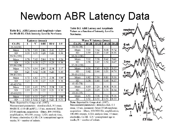 Newborn ABR Latency Data Newborn ABR Latency Data