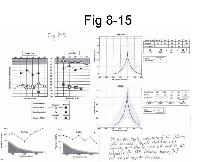 Fig 8 -15 