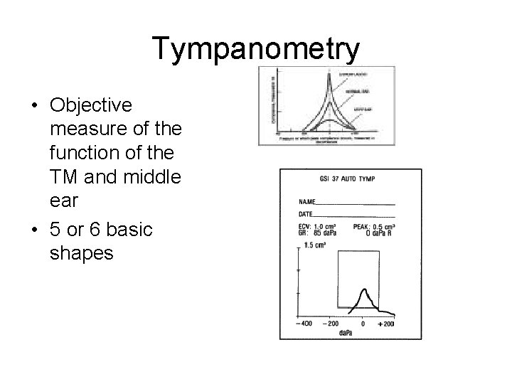 Tympanometry • Objective measure of the function of the TM and middle ear • Tympanometry • Objective measure of the function of the TM and middle ear •