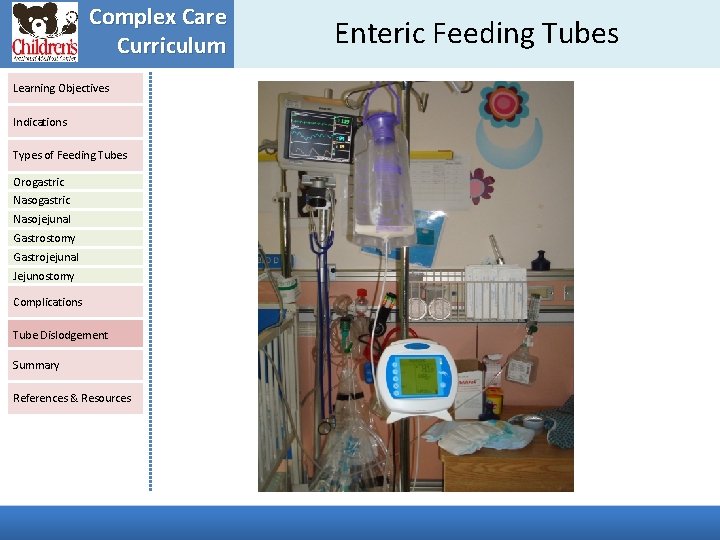 Complex Care Curriculum Learning Objectives Indications Types of Feeding Tubes Orogastric Nasojejunal Gastrostomy Gastrojejunal