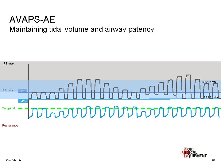 AVAPS-AE Maintaining tidal volume and airway patency PS max EPAP max PS min IPAP