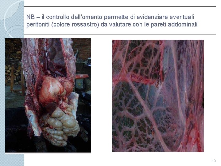 NB – il controllo dell’omento permette di evidenziare eventuali peritoniti (colore rossastro) da valutare