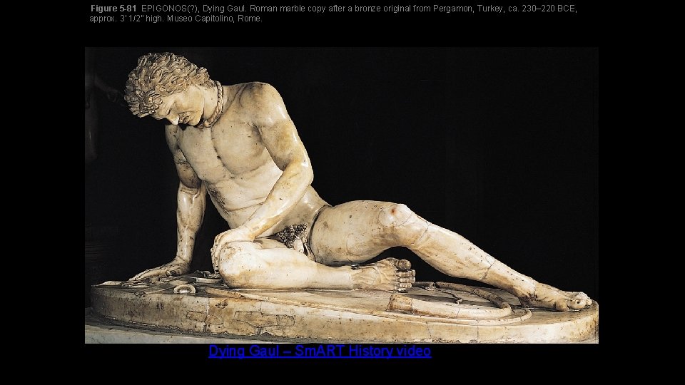 Figure 5 -81 EPIGONOS(? ), Dying Gaul. Roman marble copy after a bronze original