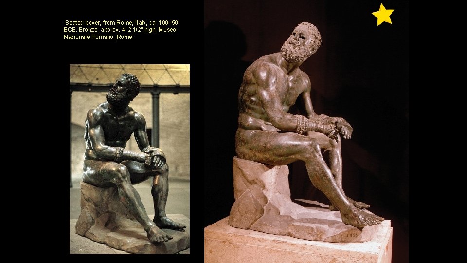 Seated boxer, from Rome, Italy, ca. 100– 50 BCE. Bronze, approx. 4’ 2 1/2”