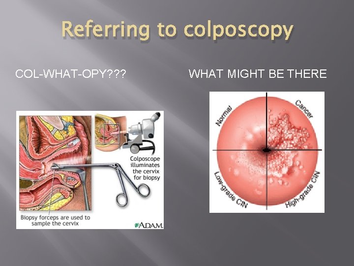 Referring to colposcopy COL-WHAT-OPY? ? ? WHAT MIGHT BE THERE 