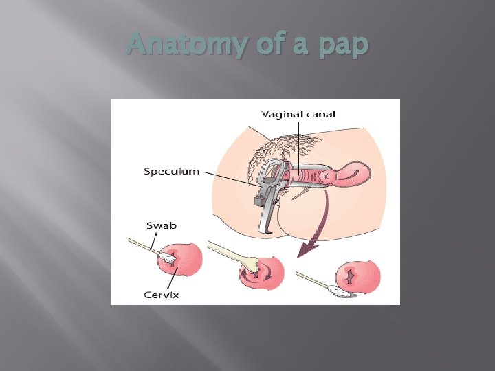 Anatomy of a pap 