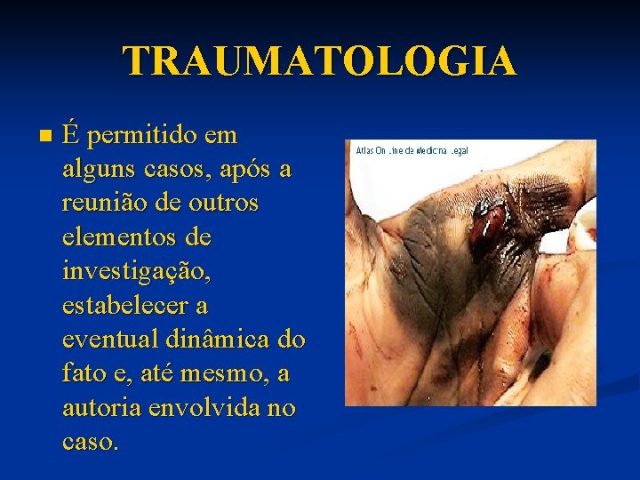 TRAUMATOLOGIA n É permitido em alguns casos, após a reunião de outros elementos de