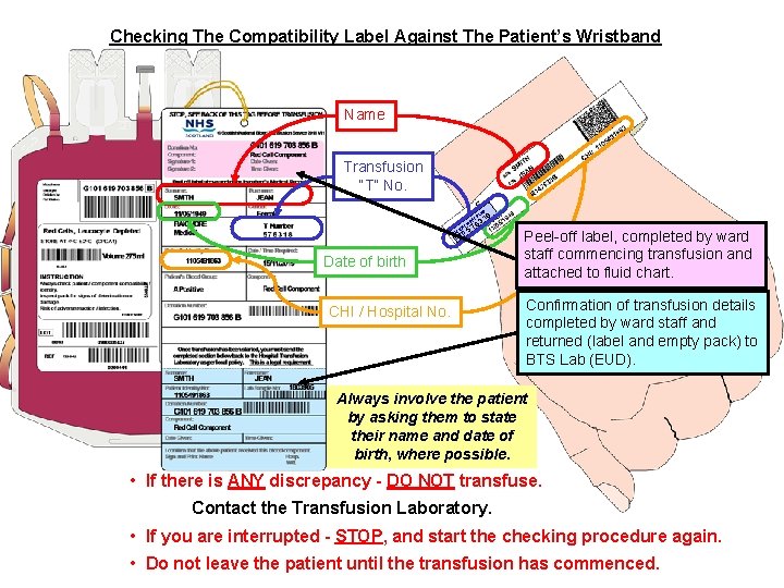 Checking The Compatibility Label Against The Patient’s Wristband Name Transfusion “T” No. ND BA