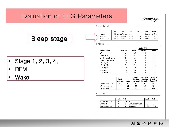 Evaluation of EEG Parameters Sleep stage • Stage 1, 2, 3, 4. • REM