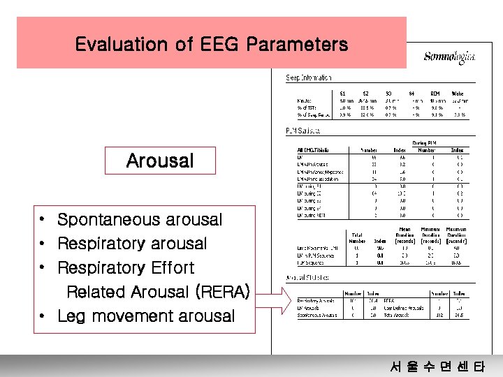 Evaluation of EEG Parameters Arousal • Spontaneous arousal • Respiratory Effort Related Arousal (RERA)