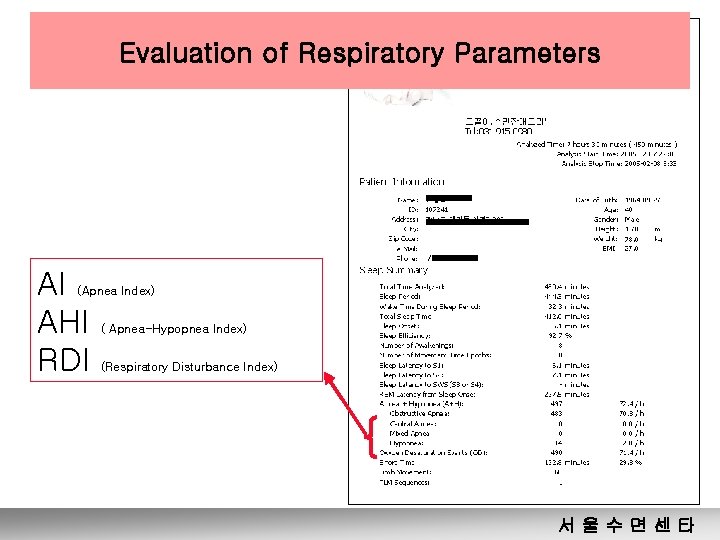 Evaluation of Respiratory Parameters AI AHI RDI (Apnea Index) ( Apnea-Hypopnea Index) (Respiratory Disturbance