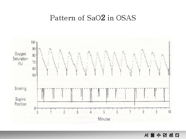 Pattern of Sa. O 2 in OSAS 서울수면센타 