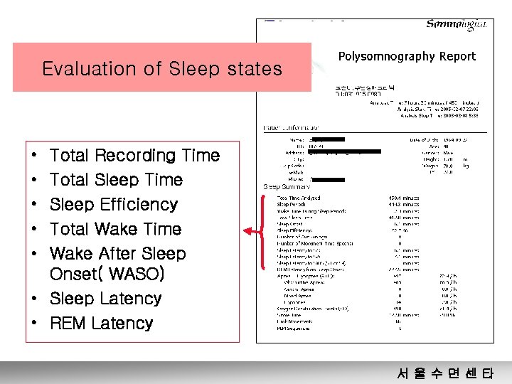 Evaluation of Sleep states • • • Total Recording Time Total Sleep Time Sleep