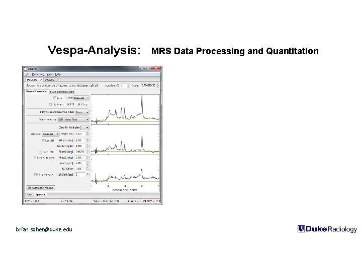 Vespa-Analysis: brian. soher@duke. edu MRS Data Processing and Quantitation 