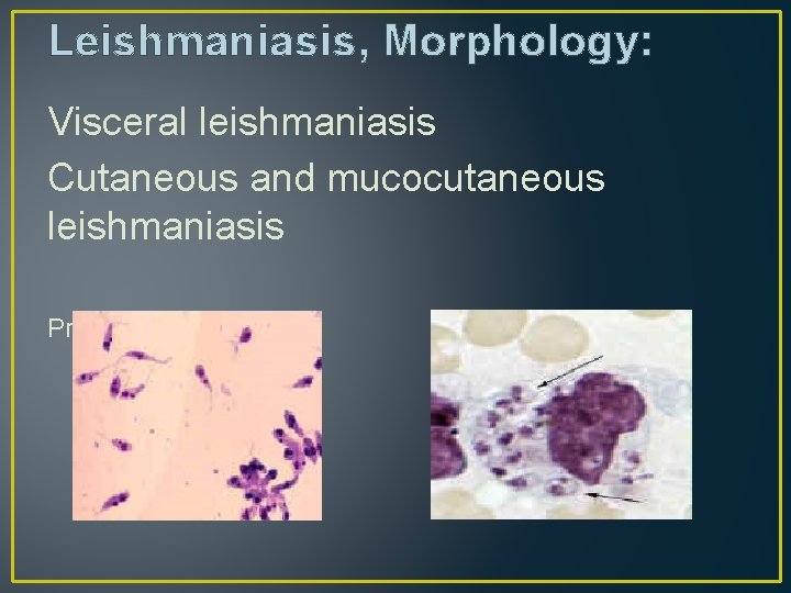 Leishmaniasis, Morphology: Visceral leishmaniasis Cutaneous and mucocutaneous leishmaniasis Promastigote: Amastigote: 