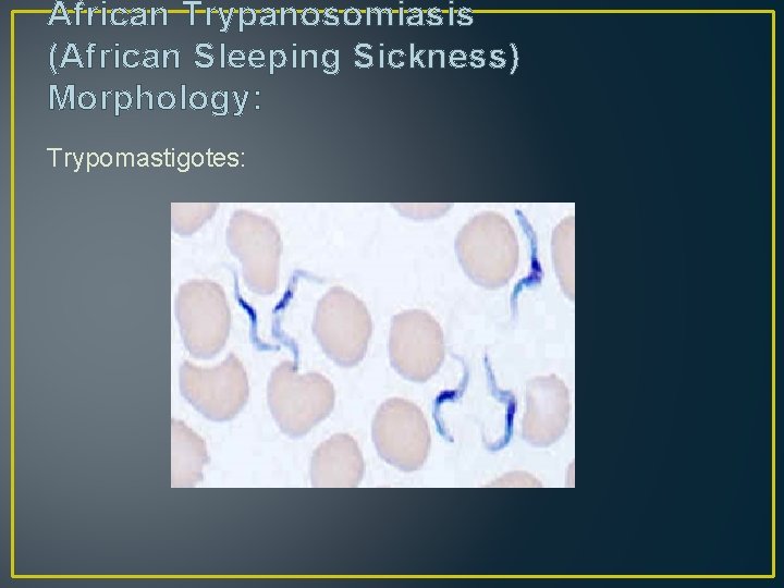 African Trypanosomiasis (African Sleeping Sickness) Morphology: Trypomastigotes: 
