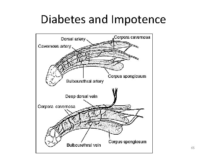 Diabetes and Impotence 65 