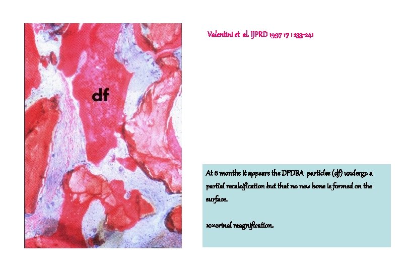 Valentini et al. IJPRD 1997 17 : 233 -241 At 6 months it appears