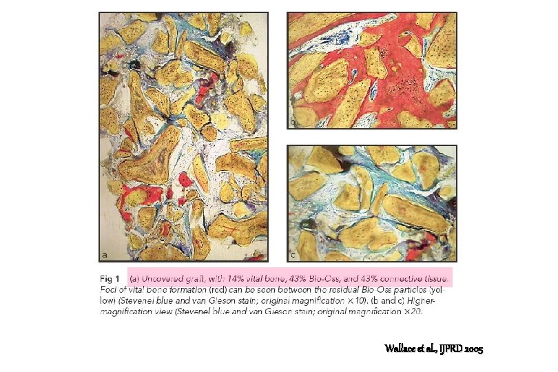Wallace et al. , IJPRD 2005 