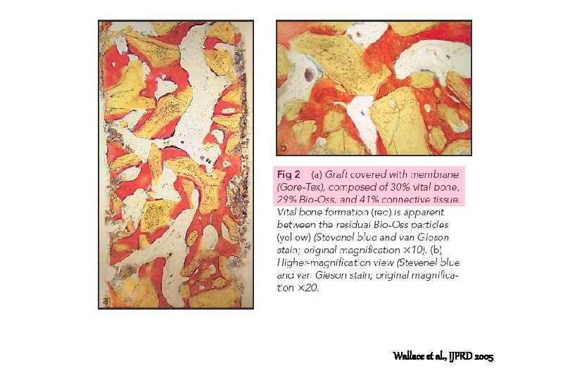 Wallace et al. , IJPRD 2005 