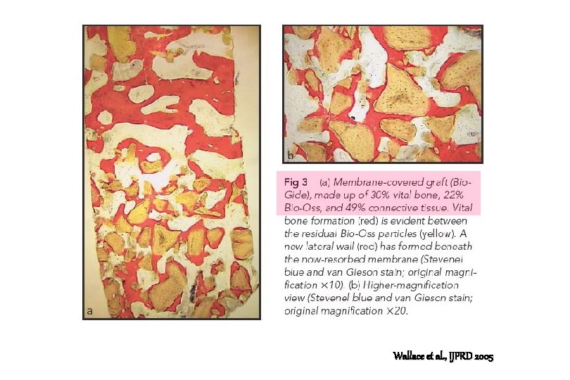 Wallace et al. , IJPRD 2005 