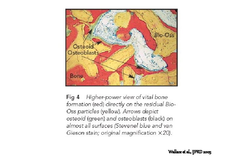 Wallace et al. , IJPRD 2005 