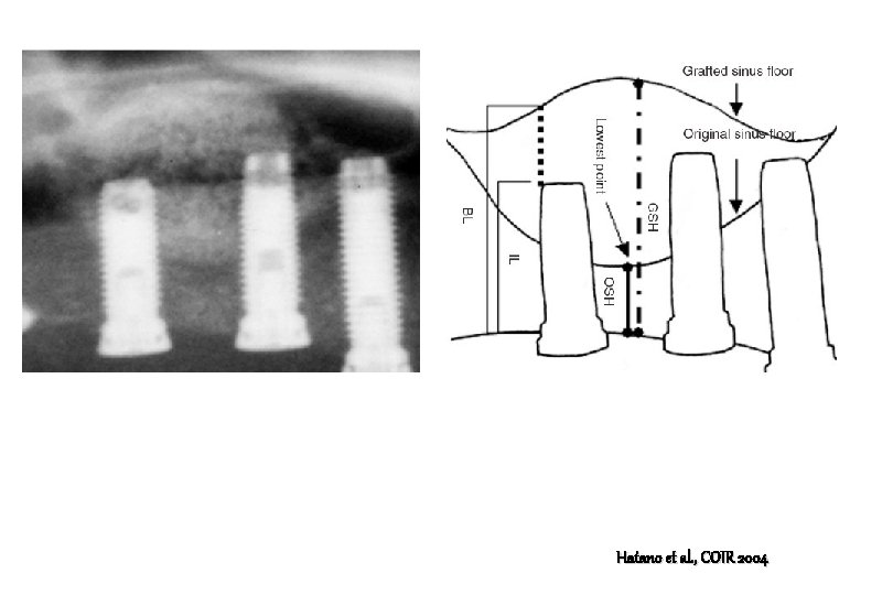 Hatano et al. , COIR 2004 