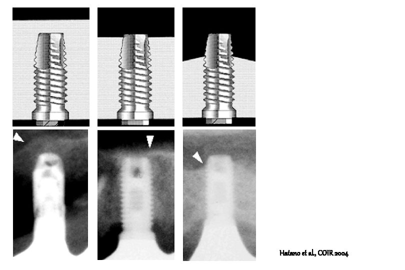 Hatano et al. , COIR 2004 