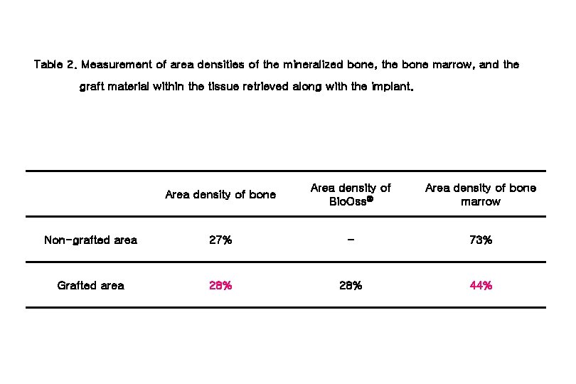 Table 2. Measurement of area densities of the mineralized bone, the bone marrow, and
