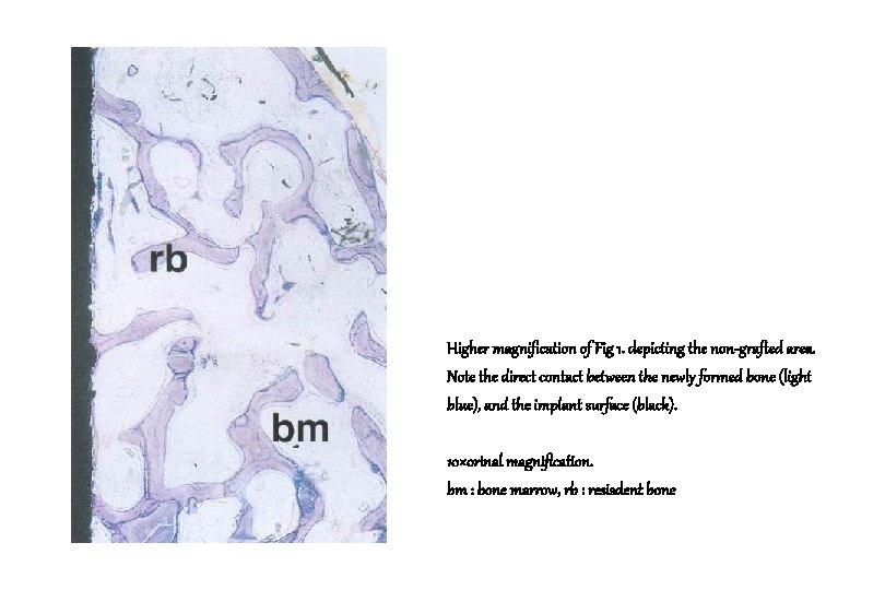 Higher magnification of Fig 1. depicting the non-grafted area. Note the direct contact between