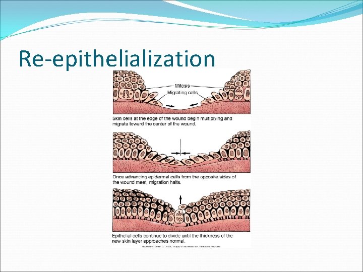 Re-epithelialization 